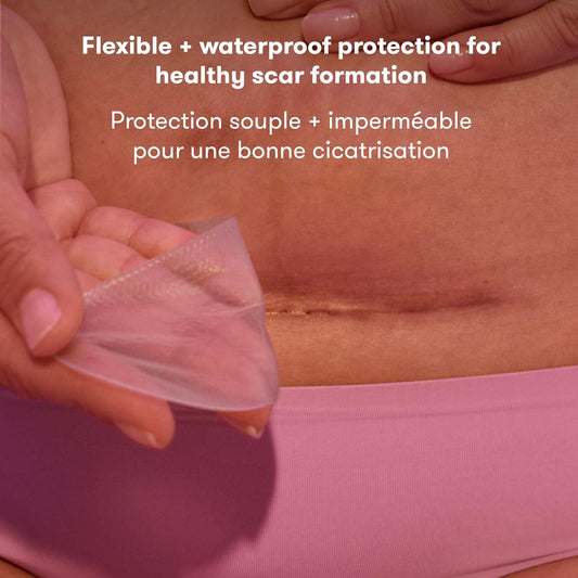 C-Section Silicone Strips, C-Section Recovery Must Have Scar Patches, Reusable Medical Grade Treatment for Keloid Scars, Includes Case & Pouch