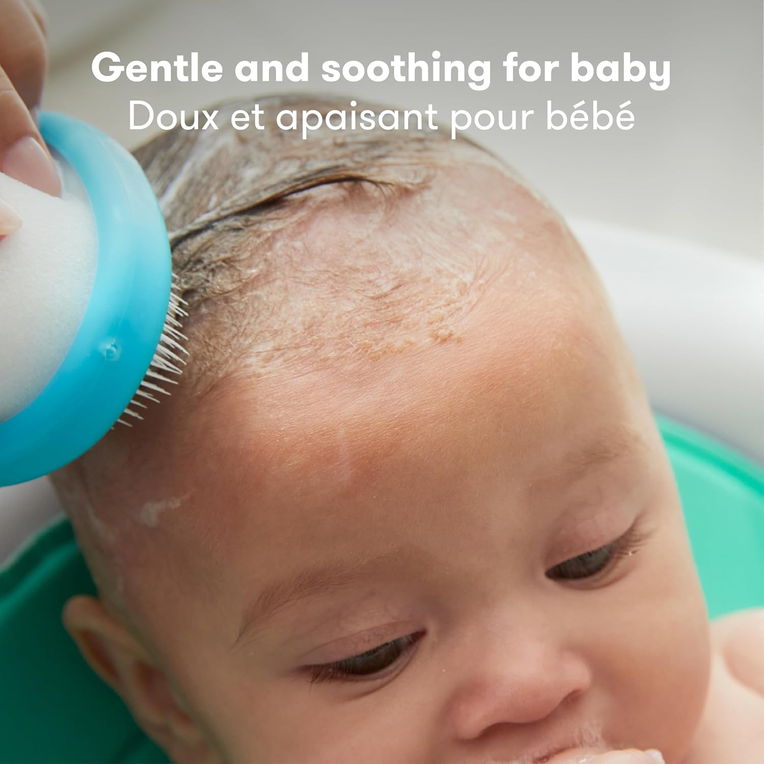 the 3-Step Cradle Cap System & Cradle Cap Treatment, Dermafrida the Flakefixer, Sponge, Brush, Comb and Storage Stand for Babies with Cradle Cap, White-Blue